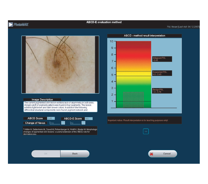 molemax-one-software-for-dermatoscopes