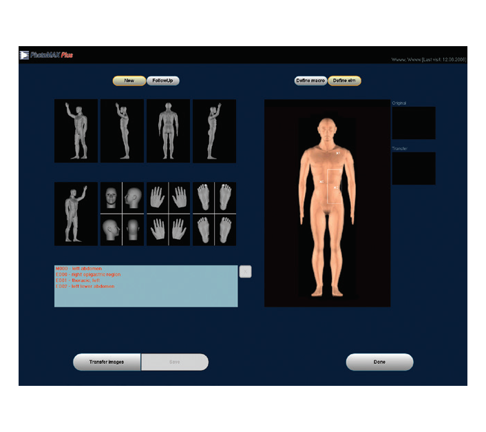 molemax-one-software pro dermatoscopes