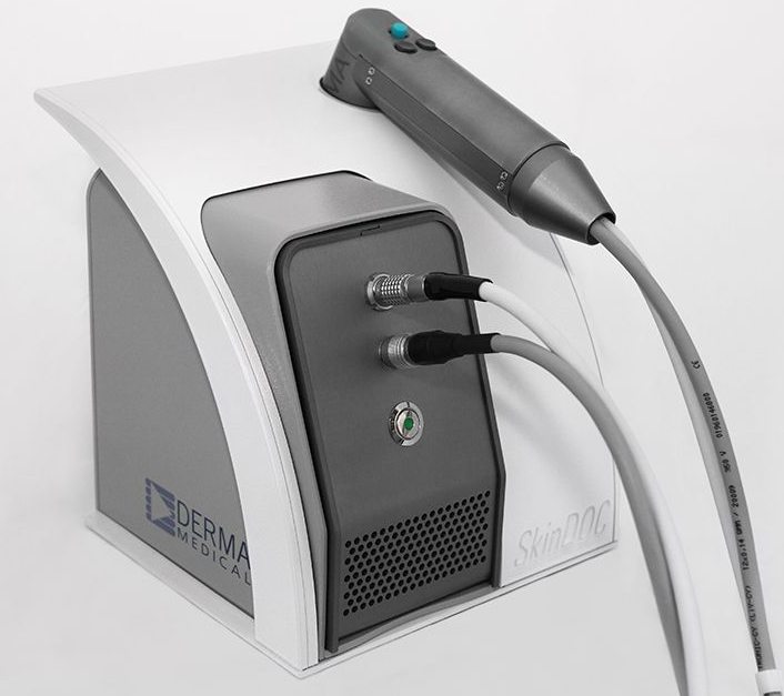 skindoc-portable-system-for-digital-dermatoscopy