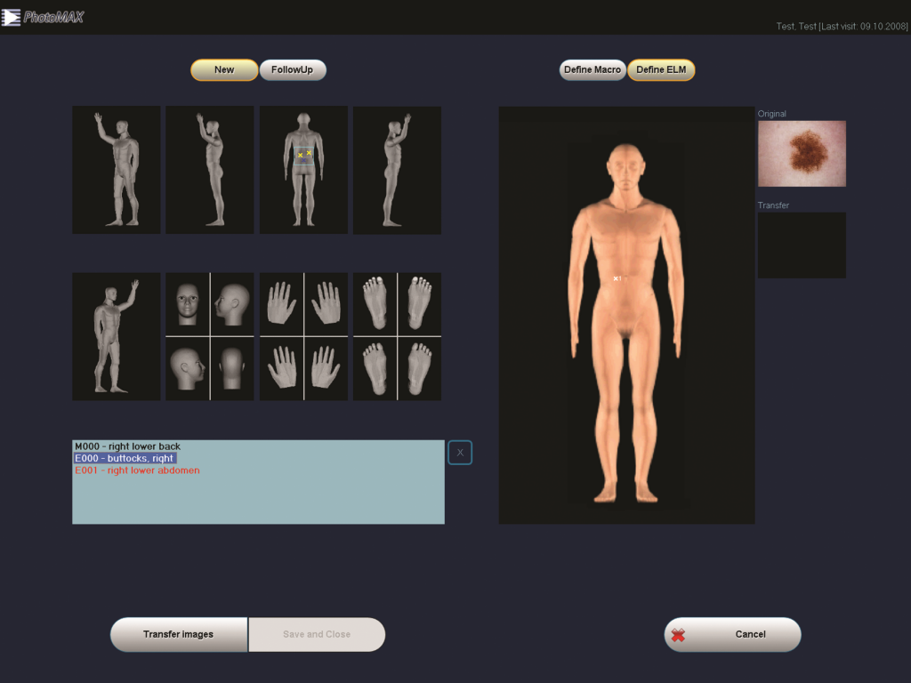molemax-Skin-Imaging-Software