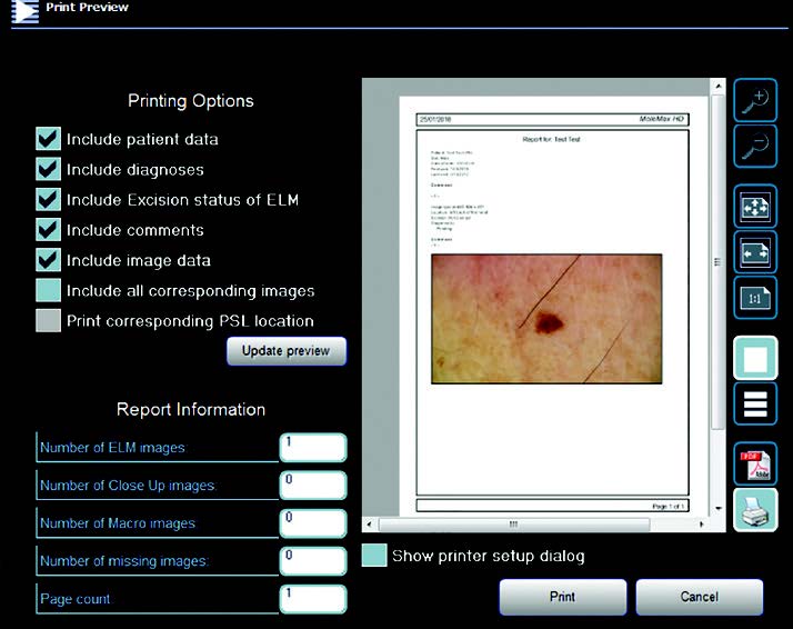 molemax-skin-image-software-pdf-export