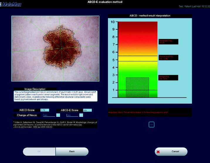 molemax-skin-imaging-software