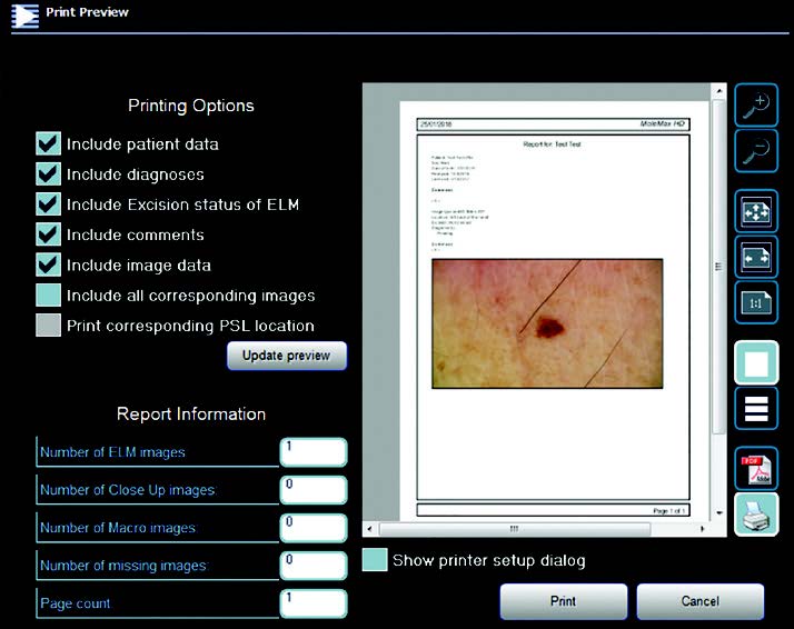 molemax-one-skin-image-software-export-pdf