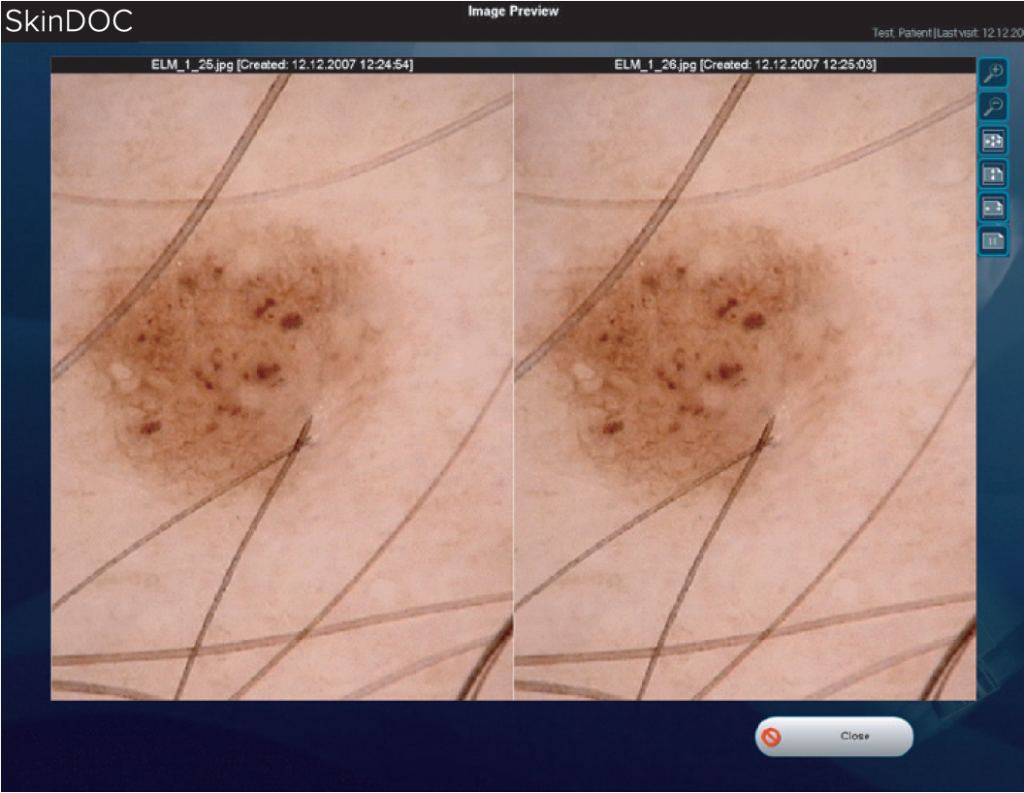 comparación de imágenes de piel en tiempo real