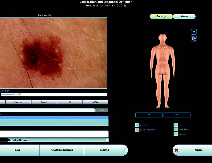 Haut-Lokalisierung-Läsion-Haut-Imaging