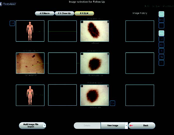 software de seguimiento de imagen de piel