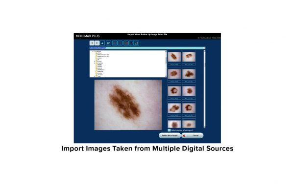 MoleMaxPlus Import Images